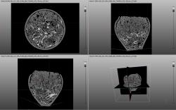 Radiographie d'une urne funraire