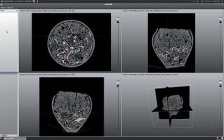 Interface de travail du logiciel SmithDR en cours dexploitation