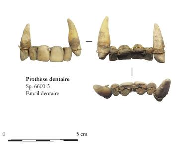 Dtail du dentier